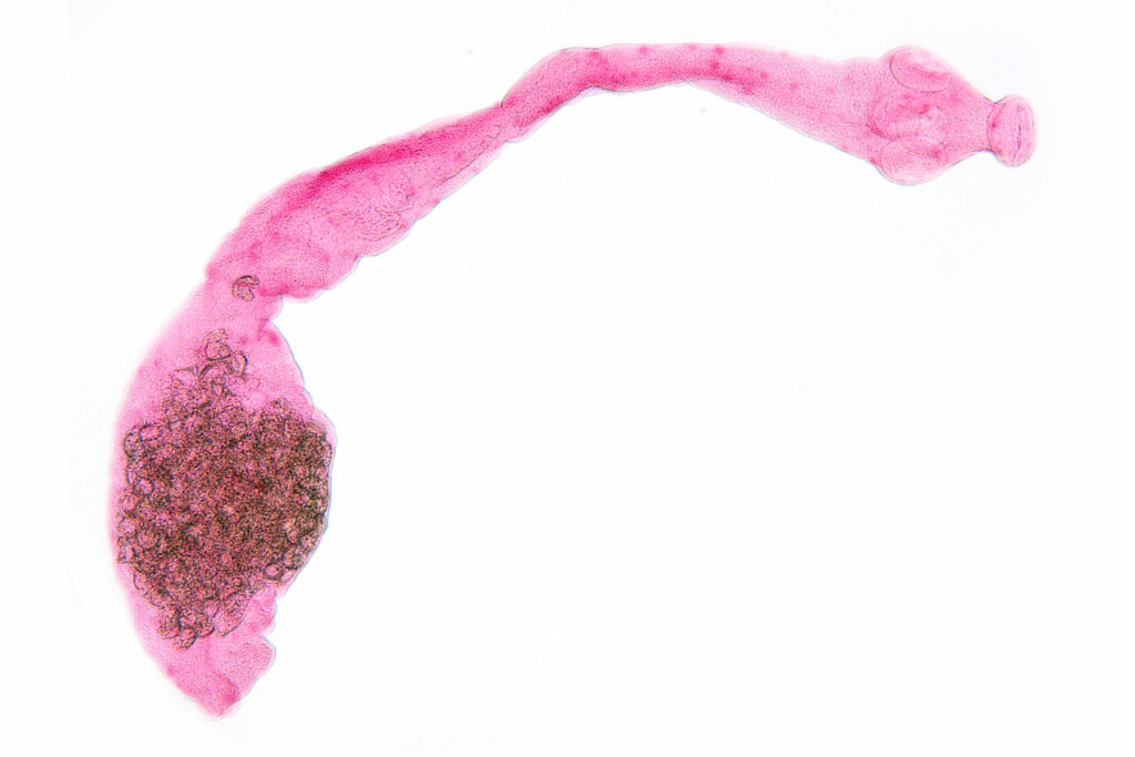 echinococcus-multilocularis-homme-ltax