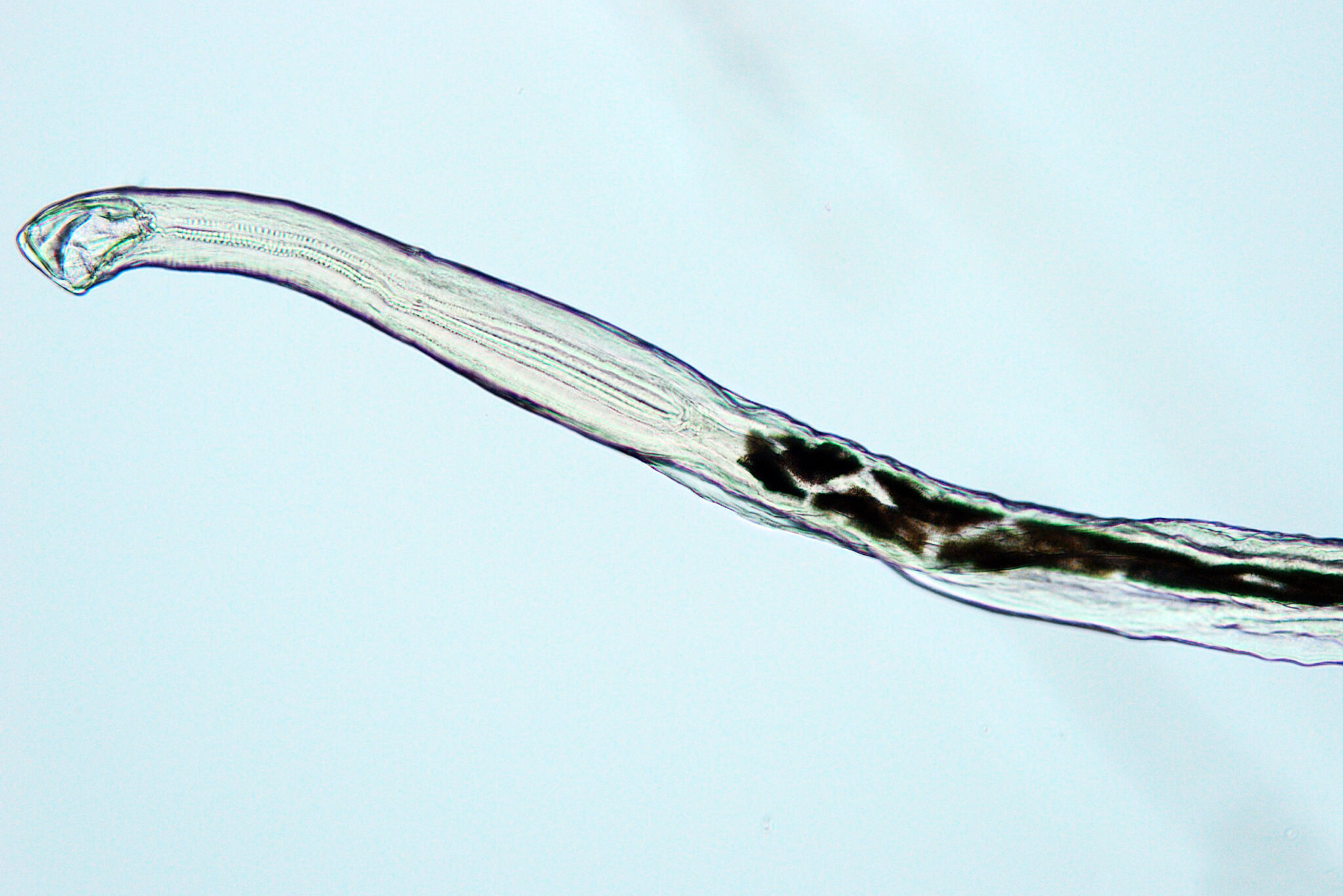 Uncinaria stenocephala ZOWIAC
